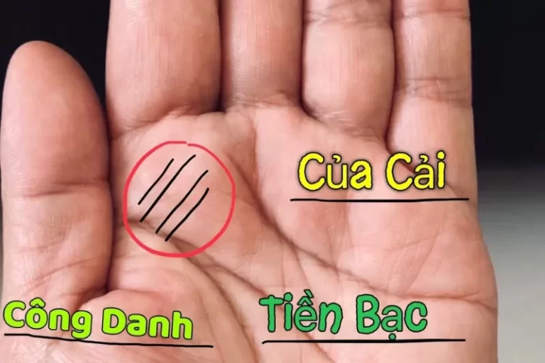 Gò Mộc Tinh Có Phải Là Dấu Hiệu Của Mệnh Phú Quý?